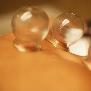 cupping-in-carousel-thumbnails