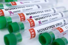 Monkeypox - Dubai authority announces isolation rules 